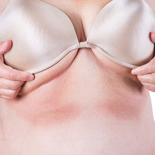 4 Common Skin Reactions Brought by Wearing the Wrong Bras